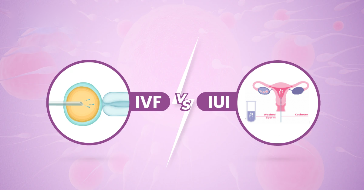 The Difference Between IUI and IVF: A Comprehensive Guide