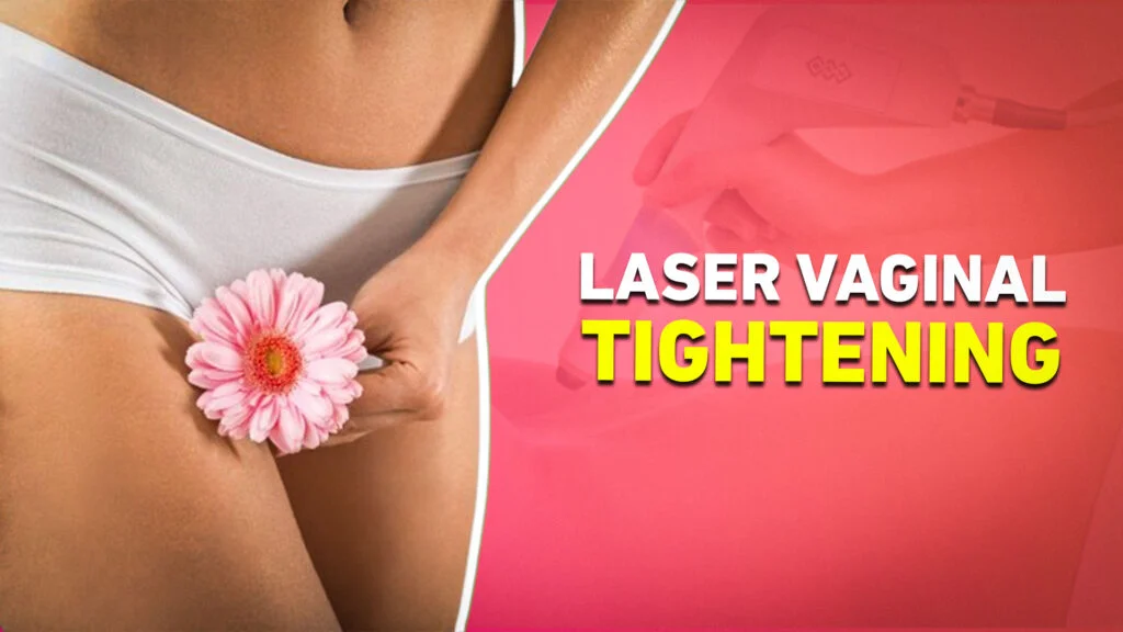 Laser Vaginal Tightening – LaBella Cosgyn Laser Vaginal Tightening Dhakoli – LaBella Cosgyn